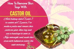Top 25 Ways How To Remove Skin Tags Naturally And Quickly