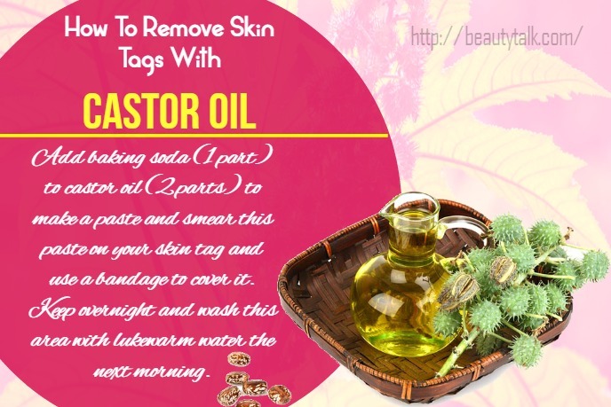 Top 25 Ways How To Remove Skin Tags Naturally And Quickly