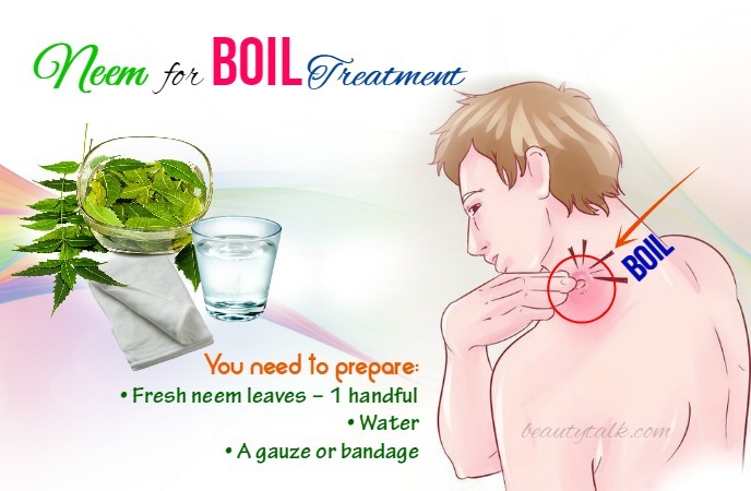 Home Remedies For Boils 