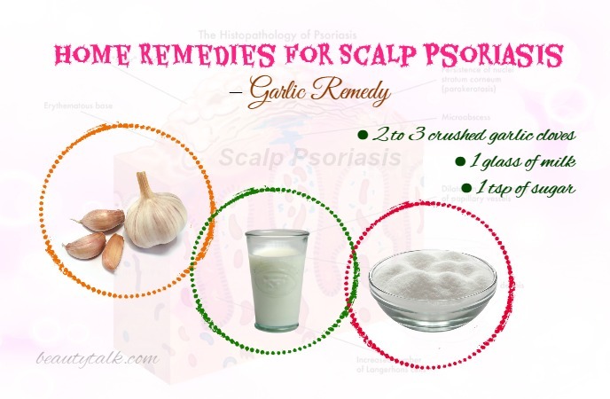 Home Remedies For Scalp Psoriasis