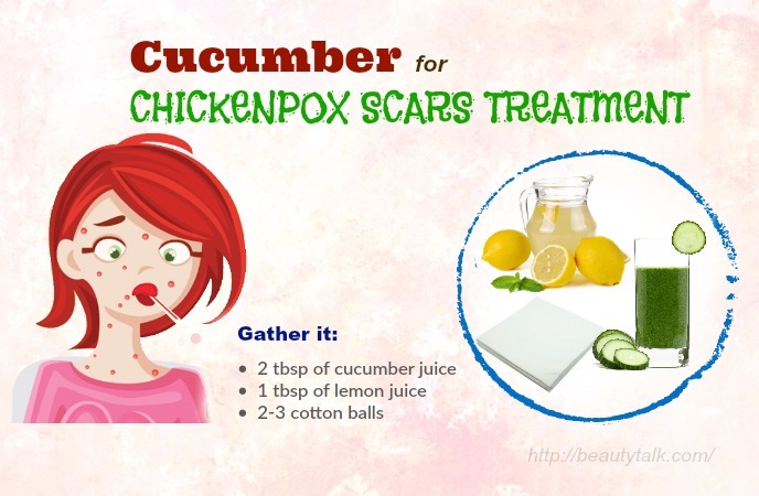 How To Get Rid Of Chickenpox Scars 