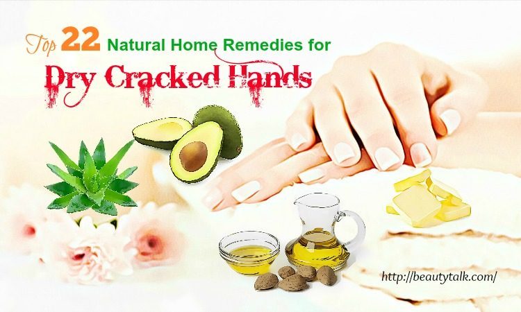 home remedies for dry cracked hands