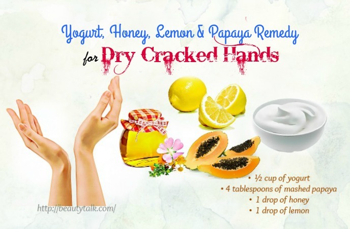 home remedies for dry cracked hands