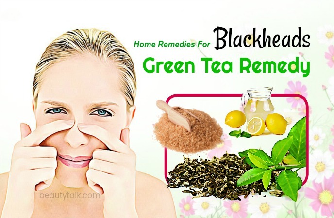 home remedies for blackheads 