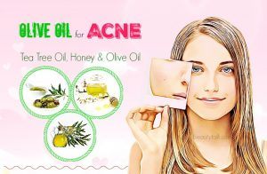 24 Common Ways On How To Use Olive Oil For Acne & Acne Scars