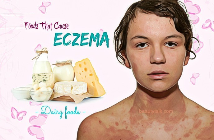 9-common-foods-that-cause-eczema-outbreaks-or-make-it-worse