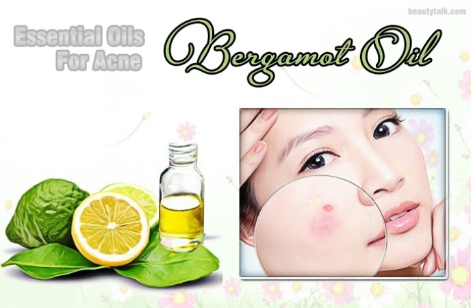 essential oils for acne - bergamot oil