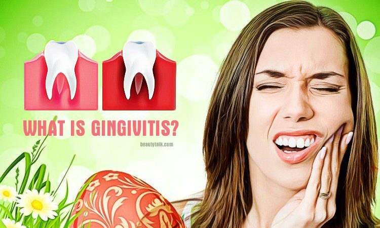 what is gingivitis