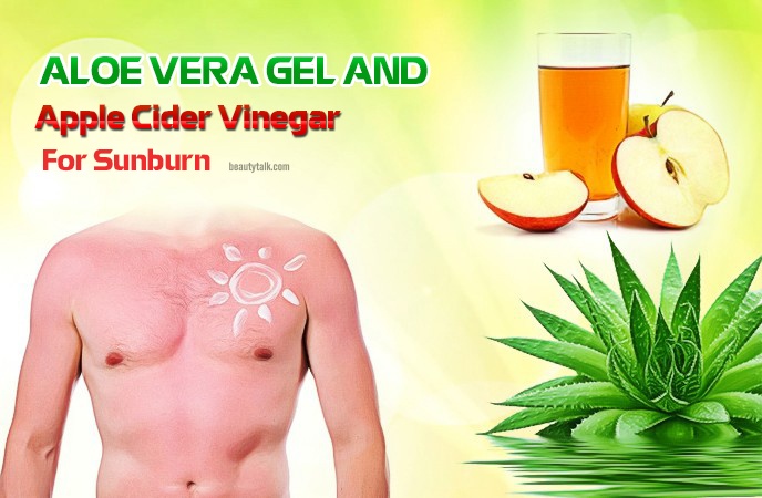 apple cider vinegar for sunburn - aloe vera gel and apple cider vinegar for sunburn