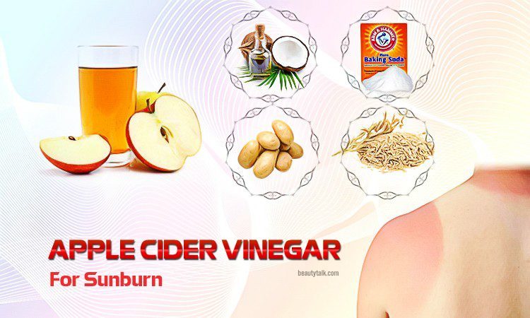 apple cider vinegar for sunburn