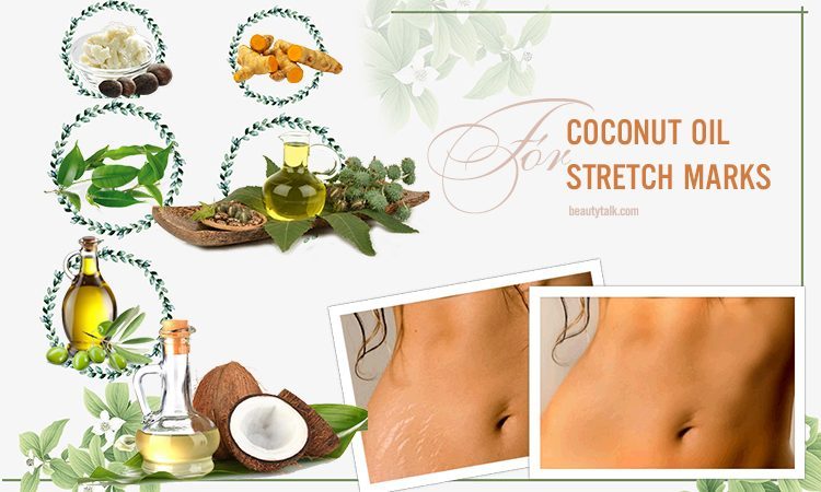 how to use coconut oil for stretch marks