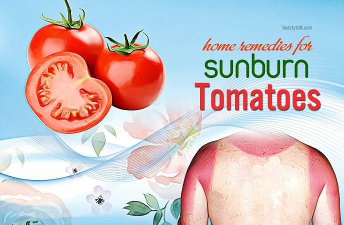 HugeDomains.com  Natural remedies for sunburn, Sunburn remedies, Natural  anti aging skin care