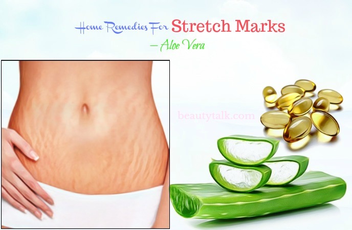 home remedies for stretch marks on breasts - aloe vera