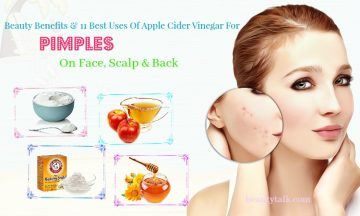 apple cider vinegar for pimples on face