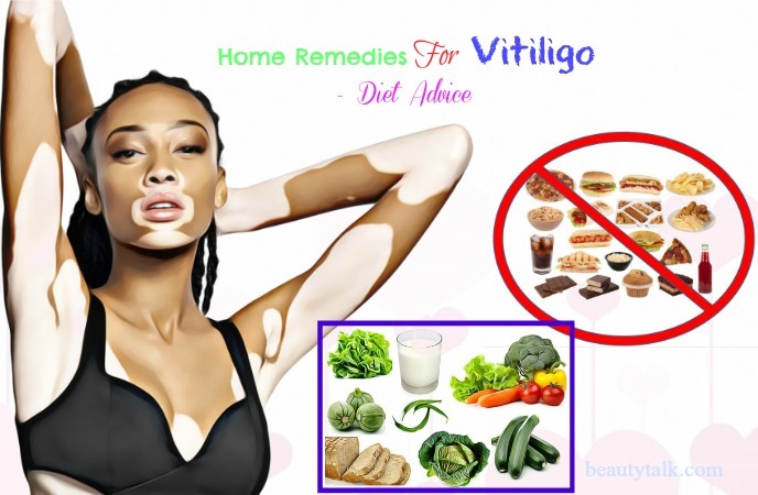 home remedies for vitiligo on face - diet advice