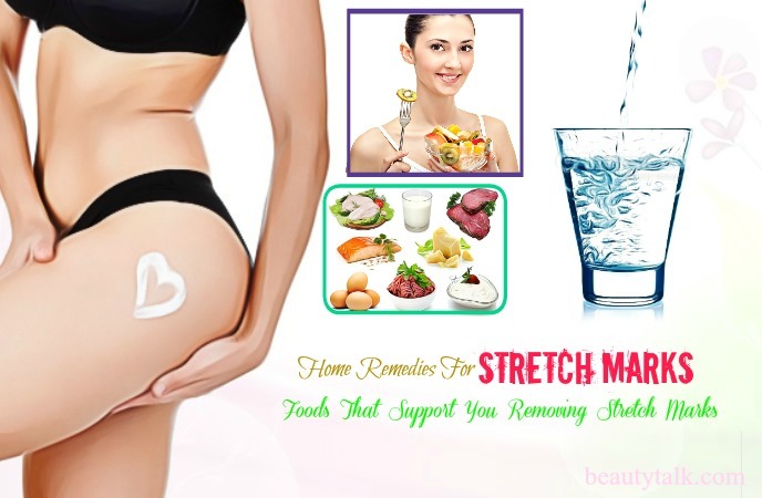 home remedies for stretch marks on thighs - foods for stretch mark removal