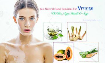 home remedies for vitiligo on face