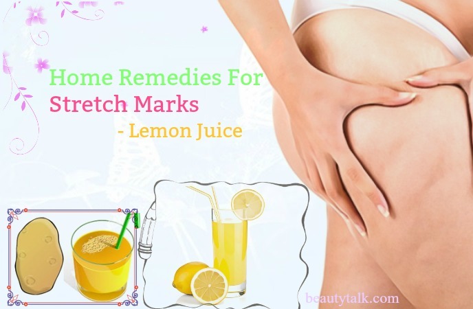 home remedies for stretch marks on bum - lemon juice