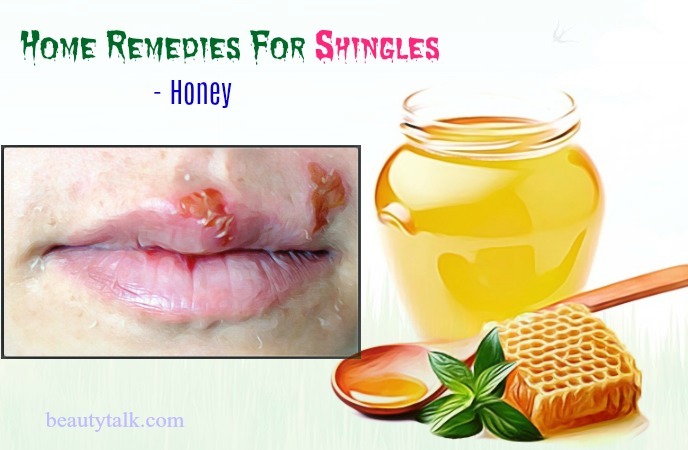 home remedies for shingles relief - honey