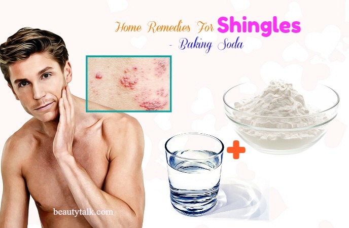 home remedies for shingles on scalp - baking soda