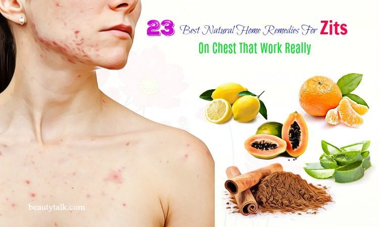 home remedies for zits on chest