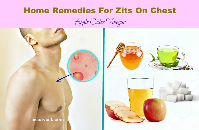 apple cider vinegar