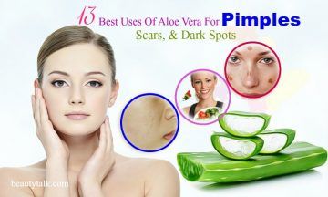 aloe vera for pimples and dark spots