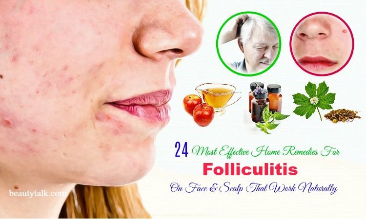 home remedies for folliculitis on face