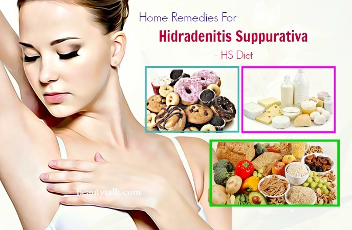 home remedies for hidradenitis suppurativa - hidradenitis suppurativa diet