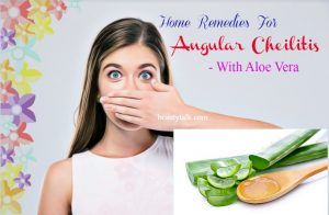 10 Natural Home Remedies For Angular Cheilitis Infection