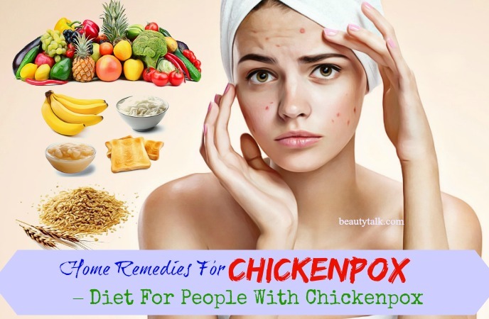 diet for people with chickenpox