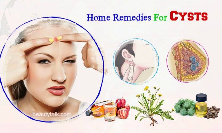 home remedies for cysts