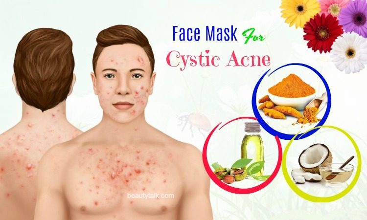 diy face mask for cystic acne