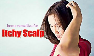 natural home remedies for itchy scalp