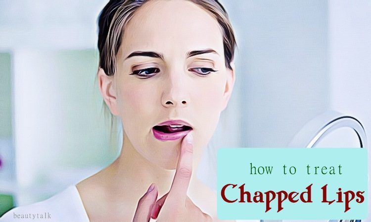 how to treat chapped lips in babies